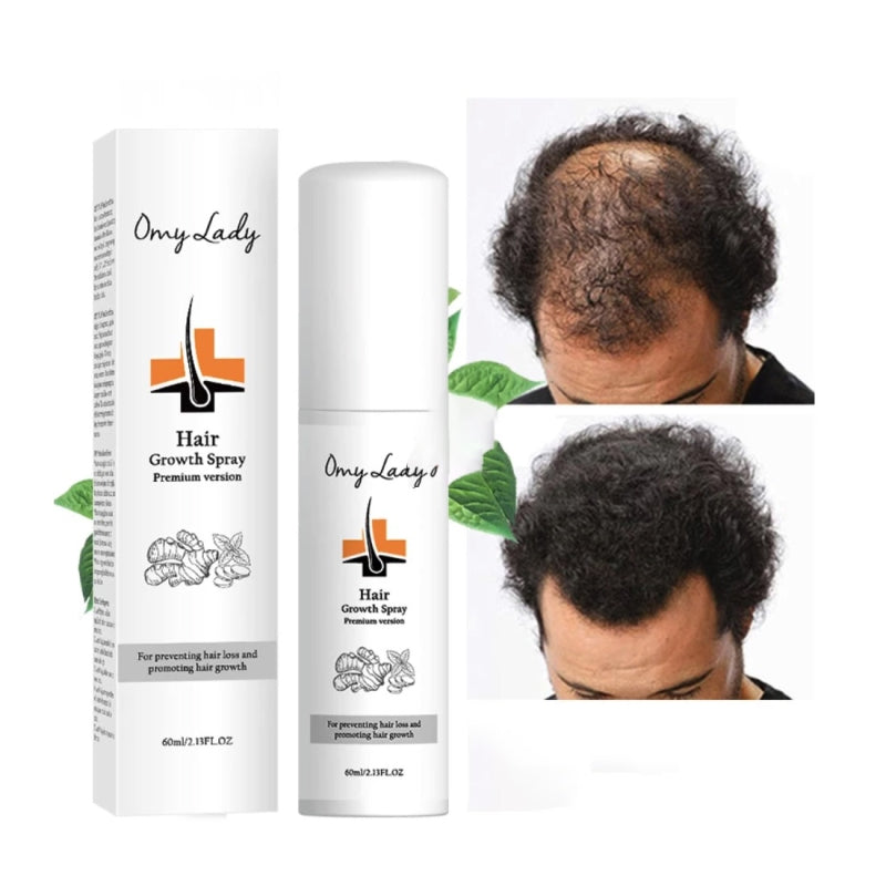 Спрей для роста волос против выпадения волос Omy Lady Hair Growth Spray 60мл