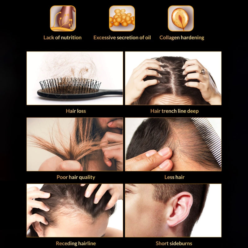 Спрей для роста волос против выпадения волос Omy Lady Hair Growth Spray 60мл