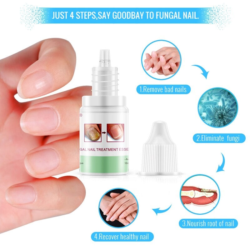Восстанавливающий крем для ногтей Omy Lady Fungal Nails Treatment 10мл