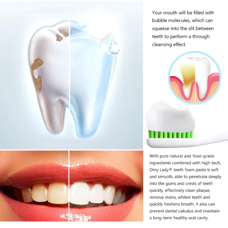 Зубная паста для отбеливания зубов Omy Lady Teeth Whitening Mousse 60мл