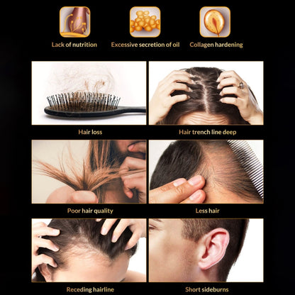 Спрей для роста волос против выпадения волос Omy Lady Hair Growth Spray 60мл