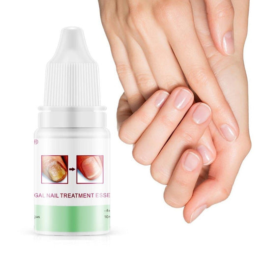 Восстанавливающий крем для ногтей Omy Lady Fungal Nails Treatment 10мл